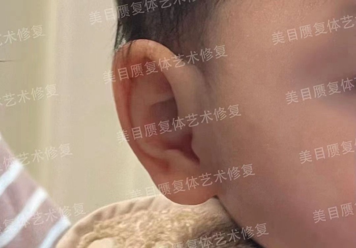 171144145.jpg d0f64fc04571474b89a6c9573612e382.jpg